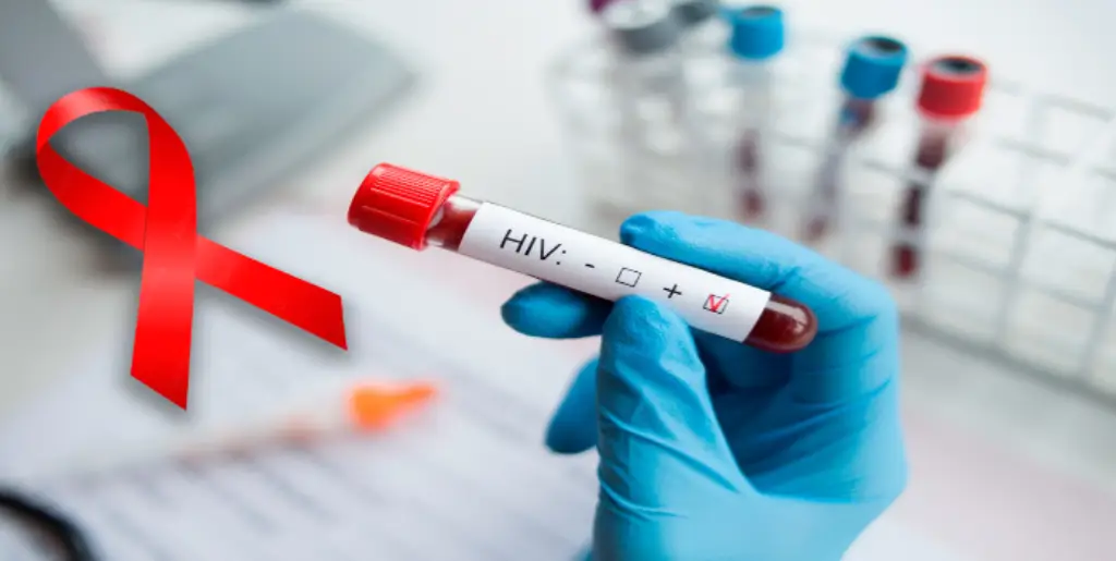 Avances prometedores en una vacuna contra el VIH