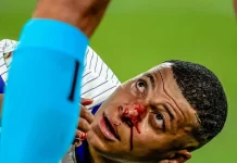 Mbappé sufre fractura nasal y pone en riesgo la Eurocopa