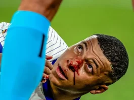 Mbappé sufre fractura nasal y pone en riesgo la Eurocopa