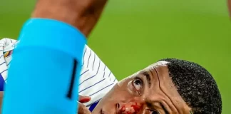 Mbappé sufre fractura nasal y pone en riesgo la Eurocopa