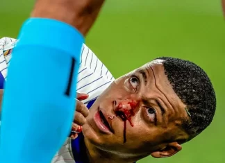 Mbappé sufre fractura nasal y pone en riesgo la Eurocopa