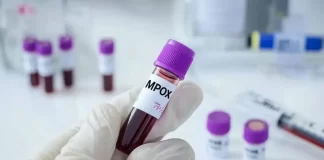 Casos de mpox aumentan en Argentina mientras otros países en alerta