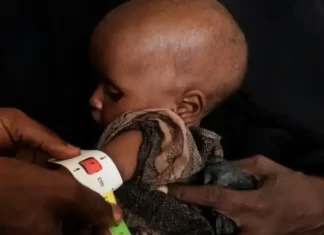 Avances en mortalidad infantil en peligro por recortes de ayuda internacional
